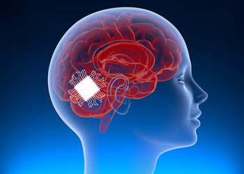 علماء يطورون أول شريحة دماغية لترجمة الأفكار إلى كلمات منطوقة