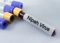 الصحة العالمية تطمئن: لا خطر لتفشي فيروس نيباه