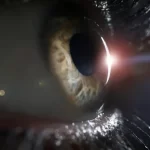 أمراض العيون الصامتة.. خطر يهدد البصر دون إنذار